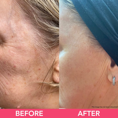 Teaology Peptide Infusion 15ml